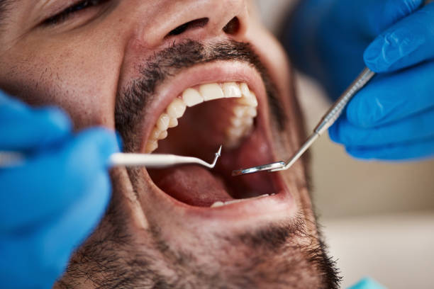 Best Emergency Tooth Extraction in Wood Ridge, NJ